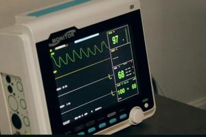 ECG monitor.